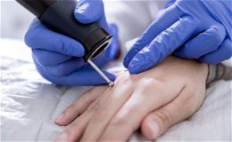 Eröffnung der hochmodernen Hautarztpraxis am 8. April 2024 in Schlüchtern
